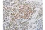 The image on the left is immunohistochemistry of paraffin-embedded Human tonsil tissue using CSB-PA988424(ADM Antibody) at dilution 1/20, on the right is treated with synthetic peptide. (Original magnification: 