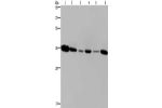 Gel: 8%SDS-PAGE, Lysate: 40 