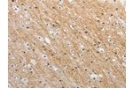 The image on the left is immunohistochemistry of paraffin-embedded Human brain tissue using CSB-PA992064(ADAMTS19 Antibody) at dilution 1/25, on the right is treated with synthetic peptide. (Original magnification: 