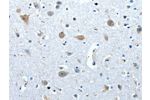 The image on the left is immunohistochemistry of paraffin-embedded Human brain tissue using CSB-PA997514(COX7B2 Antibody) at dilution 1/20, on the right is treated with fusion protein. (Original magnification: 