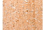 The image on the left is immunohistochemistry of paraffin-embedded Human brain tissue using CSB-PA999540(EFNA1 Antibody) at dilution 1/51, on the right is treated with fusion protein. (Original magnification: 