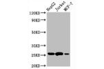 Western Blot<br />
Positive WB detected in:HepG2 whole cell lysate,Jurkat whole cell lysate,MCF-7 whole cell lysate<br />
All lanes:BCL2 antibody at 1