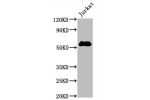 Western Blot<br />
Positive WB detected in:Jurkat whole cell lysate<br />
All lanes:CD4 antibody at 0.8