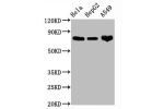 Western Blot<br />
Positive WB detected in:Hela whole cell lysate,HepG2 whole cell lysate,A549 whole cell lysate<br />
All lanes:CD44 antibody at 1.25