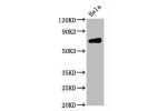 Western Blot<br />
Positive WB detected in:Hela whole cell lysate<br />
All lanes:CD86 antibody at 0.55