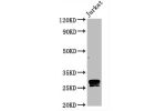 Western Blot<br />
Positive WB detected in:Jurkat whole cell lysate<br />
All lanes:CD99 antibody at 0.8