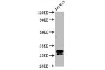Western Blot<br />
Positive WB detected in:Jurkat whole cell lysate<br />
All lanes:CD99 antibody at 0.8