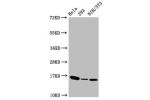 Western Blot<br />
Positive WB detected in:Hela whole cell lysate,293 whole cell lysate,NIH/3T3 whole cell lysate<br />
All lanes:Phospho-Histone H3 (T3) antibody at 1.41