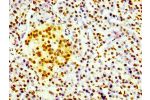 IHC image of CSB-RA010109A0HU diluted at 1:100 and staining in paraffin-embedded human pancreatic tissue performed on a Leica BondTM system. After dewaxing and hydration, antigen retrieval was mediated by high pressure in a citrate buffer (pH 6.0). Sectio