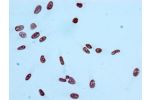 Immunocytochemistry analysis of CSB-RA010385A09acHU diluted at 1:100 and staining in Hela cells performed on a Leica BondTM system. After dewaxing and hydration, antigen retrieval was mediated by high pressure in a citrate buffer (pH 6.0). Section was blo