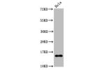 Western Blot<br />
Positive WB detected in:Hela whole cell lysate treated by 15mM sodium butyrate for 30min<br />
All lanes:Acetyl-Histone H2B type 1-B(K20)antibody at 0.135