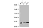 Western Blot<br />
Positive WB detected in:Mouse brain tissue,Rat liver tissue,Rat lung tissue<br />
All lanes:Histone H2B type 1-K antibody at 0.16