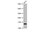 Western Blot<br />
Positive WB detected in:Hela whole cell lysate treated by 15mM sodium butyrate for 30min<br />
All lanes:Acetyl-Histone H3.1(K4)antibody at 1.1