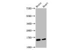 Western Blot<br />
Positive WB detected in:Mouse brain tissue,Mouse heart tissue<br />
All lanes:Di-methyl-Histone H3.1(K4)antibody at 0.55