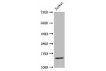 Western Blot<br />
Positive WB detected in:Jurkat whole cell lysate<br />
All lanes:Histone H3.1 antibody at 1.5