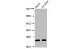 Western Blot<br />
Positive WB detected in:HepG2 whole cell lysate,SH-SY5Y whole cell lysate<br />
All lanes:Mono-methyl-Histone H3.1(R128)antibody at 0.87