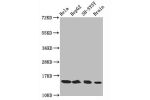 Western Blot<br />
Positive WB detected in:Hela whole cell lysate,HepG2 whole cell lysate,SH-SY5Y whole cell lysate,Rat brain tissue<br />
All lanes:Acetyl-Histone H3.1(K14)antibody at 0.75