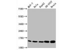 Western Blot<br />
Positive WB detected in:MCF-7 whole cell lysate,Hela whole cell lysate,HepG2 whole cell lysate,SH-SY5Y whole cell lysate,Rat brain tissue<br />
All lanes:Mono-methyl-Histone H3.1(K18)antibody at 0.7