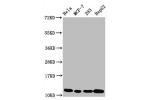 Western Blot<br />
Positive WB detected in:Hela whole cell lysate,MCF-7 whole cell lysate,293 whole cell lysate,HepG2 whole cell lysate<br />
All lanes:Acetyl-Histone H4 (K5) antibody at 1.05