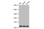 Western Blot<br />
Positive WB detected in:293 whole cell lysate,HepG2 whole cell lysate,Mouse kidney tissue<br />
All lanes:Acetyl-Histone H4 (K16) antibody at 1.65