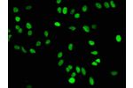 Immunofluorescence staining of Hela cells with CSB-RA010429A16me1HU at 1:50,counter-stained with DAPI. The cells were fixed in 4% formaldehyde, permeabilized using 0.2% Triton X-100 and blocked in 10% normal Goat Serum. The cells were then incubated with 