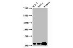 Western Blot<br />
Positive WB detected in:MCF-7 whole cell lysate,Mouse brain tissue,Mouse kidney tissue<br />
All lanes:Tri-methyl-Histone H4 (K20) antibody at 2.15