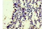 IHC image of CSB-RA801238A0HU diluted at 1:100 and staining in paraffin-embedded human lung tissue performed on a Leica BondTM system. After dewaxing and hydration, antigen retrieval was mediated by high pressure in a citrate buffer (pH 6.0). Section was 