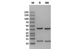 Human FcRn on Coomassie Blue stained SDS-PAGE under non-reducing (NR) and reducing (R) conditions. The upper band is the FCGRT 'heavy' chain and the lower band is the B2M 'light' chain. The purity of the protein is greater than 95%.