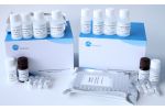 Human Anti-GM1 (Anti-Ganglioside M1 Antibody) ELISA Kit