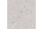 Immunohistochemical staining of human cerebral cortex shows strong positivity in nucleoli in neurons.