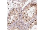 Immunohistochemical staining of human testis shows strong nuclear positivity in a subset of cells.