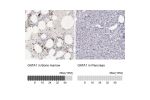 Immunohistochemistry analysis in human bone marrow and pancreas tissues using HPA000232 antibody. Corresponding GATA1 RNA-seq data are presented for the same tissues.