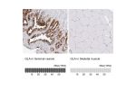 Immunohistochemistry analysis in human seminal vesicle and skeletal muscle tissues using HPA000237 antibody. Corresponding GLA RNA-seq data are presented for the same tissues.