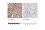 Immunohistochemistry analysis in human liver and kidney tissues using HPA000243 antibody. Corresponding OTC RNA-seq data are presented for the same tissues.
