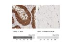 Immunohistochemistry analysis in human testis and skeletal muscle tissues using HPA000247 antibody. Corresponding G6PD RNA-seq data are presented for the same tissues.
