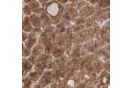 Immunohistochemical staining of human adrenal gland shows strong membranous and cytoplasmic positivity in glandular cells.