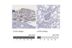 Immunohistochemistry analysis in human breast and kidney tissues using HPA000264 antibody. Corresponding ETV6 RNA-seq data are presented for the same tissues.