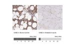 Immunohistochemistry analysis in human bone marrow and skeletal muscle tissues using HPA000271 antibody. Corresponding GAB2 RNA-seq data are presented for the same tissues.