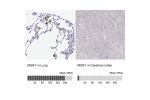 Immunohistochemistry analysis in human lung and cerebral cortex tissues using HPA000272 antibody. Corresponding MSR1 RNA-seq data are presented for the same tissues.