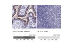 Immunohistochemistry analysis in human small intestine and tonsil tissues using HPA000288 antibody. Corresponding ACE2 RNA-seq data are presented for the same tissues.