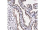 Immunohistochemical staining of human fallopian tube shows weak nuclear positivity in glandular cells.