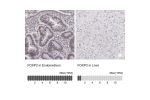 Immunohistochemistry analysis in human endometrium and liver tissues using HPA000383 antibody. Corresponding FOXP2 RNA-seq data are presented for the same tissues.