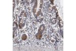 Immunohistochemical staining of human upper gastrointestinal shows moderate granular positivity in cytoplasm in glandular cells.