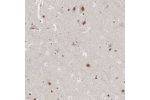 Immunohistochemical staining of human cerebral cortex shows moderate nuclear positivity in neuronal cells.