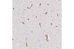 Immunohistochemical staining of human cerebral cortex shows strong cytoplasmic positivity in endothelial cells.