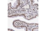 Immunohistochemical staining of human gall bladder shows distinct nuclear positivity in glandular cells.