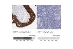 Immunohistochemistry analysis in human urinary bladder and lymph node tissues using HPA000452 antibody. Corresponding KRT17 RNA-seq data are presented for the same tissues.