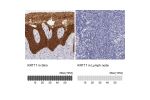 Immunohistochemistry analysis in human skin and lymph node tissues using HPA000453 antibody. Corresponding KRT17 RNA-seq data are presented for the same tissues.