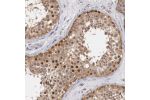 Immunohistochemical staining of human testis shows moderate nuclear positivity in cells in seminiferous ducts.