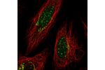 Immunofluorescent staining of human cell line SiHa shows localization to nuclear bodies & the Golgi apparatus.